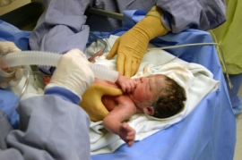 Yenidoğulmuşların (Neonatal) reanimasiya proqramı